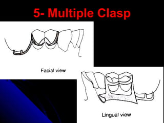 5- Multiple Clasp5- Multiple Clasp
 
