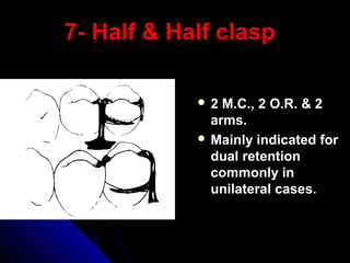 7- Half & Half clasp7- Half & Half clasp
 2 M.C., 2 O.R. & 22 M.C., 2 O.R. & 2
arms.arms.
 Mainly indicated forMainly indicated for
dual retentiondual retention
commonly incommonly in
unilateral cases.unilateral cases.
 