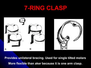 7-RING CLASP7-RING CLASP
Provides unilateral bracing. Used for single tilted molars
More flexible than aker because it is one arm clasp.
 