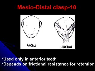 1010--Mesio-Distal claspMesio-Distal clasp
•Used only in anterior teeth
•Depends on frictional resistance for retention
 