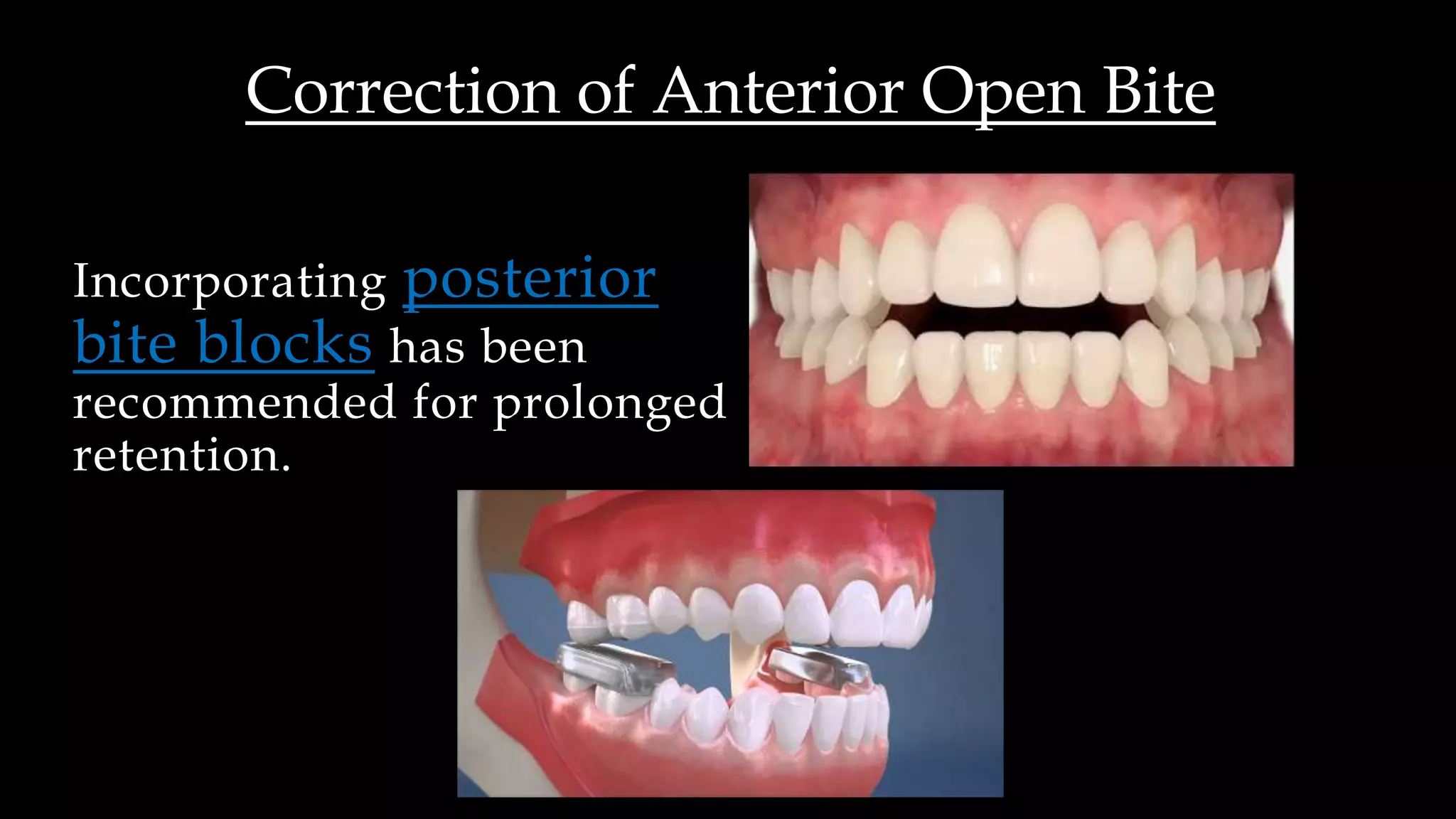 Retention dr-shareef shanableh | PPTX