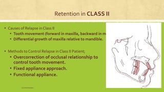 Retention in CLASS II
▪ Causes of Relapse in Class II
▪ Tooth movement (forward in maxilla, backward in mandible)
▪ Differential growth of maxilla relative to mandible.
▪ Methods to Control Relapse in Class II Patient;
▪ Overcorrection of occlusal relationship to
control tooth movement.
▪ Fixed appliance approach.
▪ Functional appliance.
S.S Hotchandani 11
 