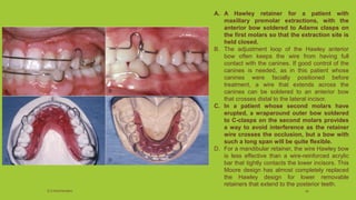 A. A Hawley retainer for a patient with
maxillary premolar extractions, with the
anterior bow soldered to Adams clasps on
the first molars so that the extraction site is
held closed.
B. The adjustment loop of the Hawley anterior
bow often keeps the wire from having full
contact with the canines. If good control of the
canines is needed, as in this patient whose
canines were facially positioned before
treatment, a wire that extends across the
canines can be soldered to an anterior bow
that crosses distal to the lateral incisor.
C. In a patient whose second molars have
erupted, a wraparound outer bow soldered
to C-clasps on the second molars provides
a way to avoid interference as the retainer
wire crosses the occlusion, but a bow with
such a long span will be quite flexible.
D. For a mandibular retainer, the wire Hawley bow
is less effective than a wire-reinforced acrylic
bar that tightly contacts the lower incisors. This
Moore design has almost completely replaced
the Hawley design for lower removable
retainers that extend to the posterior teeth.
S.S Hotchandani 30
 