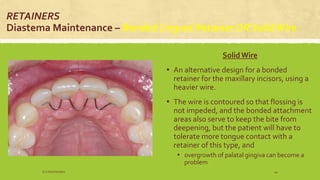 RETAINERS
Diastema Maintenance – Bonded Lingual Retainer OR SolidWire
Solid Wire
▪ An alternative design for a bonded
retainer for the maxillary incisors, using a
heavier wire.
▪ The wire is contoured so that flossing is
not impeded, and the bonded attachment
areas also serve to keep the bite from
deepening, but the patient will have to
tolerate more tongue contact with a
retainer of this type, and
▪ overgrowth of palatal gingiva can become a
problem
S.S Hotchandani 44
 