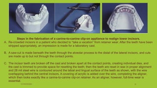 Steps in the fabrication of a canine-to-canine clip-on appliance to realign lower incisors.
A. Re-crowded incisors in a patient who decided to “take a vacation” from retainer wear. After the teeth have been
stripped appropriately, an impression is made for a laboratory cast.
B. A saw-cut is made beneath the teeth through the alveolar process to the distal of the lateral incisors, and cuts
are made up to but not through the contact points.
C. The incisor teeth are broken off the cast and broken apart at the contact points, creating individual dies, and
the cast is trimmed to provide space for resetting the teeth; then the teeth are reset in wax in proper alignment
and 28 mil steel wire is contoured around the labial and lingual surface of the teeth as shown, with the wire
overlapping behind the central incisors. A covering of acrylic is added over the wire, completing the aligner,
which then looks exactly like a canine-to-canine clip-on retainer. As an aligner, however, full-time wear is
essential.
S.S Hotchandani 52
 