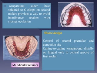 Retention-and-Relapse- for dental medicine students.pptx