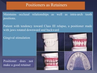 Tooth Positioner Retainer Retention-and-Relapse- for dental medicine students.pptx