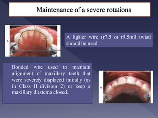 Retention-and-Relapse- for dental medicine studentsPpt.pptx
