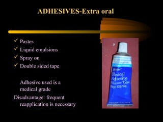  Pastes
 Liquid emulsions
 Spray on
 Double sided tape
Adhesive used is a
medical grade
Disadvantage: frequent
reapplication is necessary
ADHESIVES-Extra oral
 