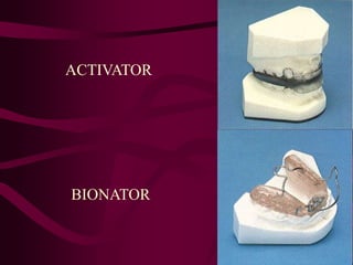 ACTIVATOR
BIONATOR
 