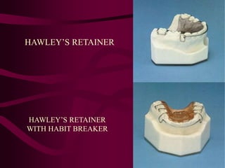 HAWLEY’S RETAINER
HAWLEY’S RETAINER
WITH HABIT BREAKER
 