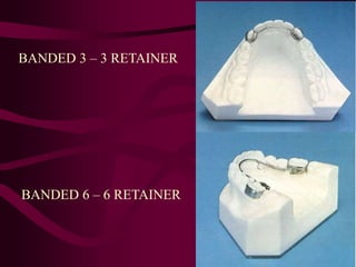 BANDED 3 – 3 RETAINER
BANDED 6 – 6 RETAINER
 