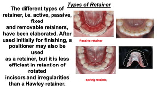 Retention after orthodontic therapy | PPTX