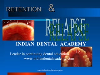 RETENTION

&

INDIAN DENTAL ACADEMY
Leader in continuing dental education
www.indiandentalacademy.com
www.indinadentalacademy.com

 