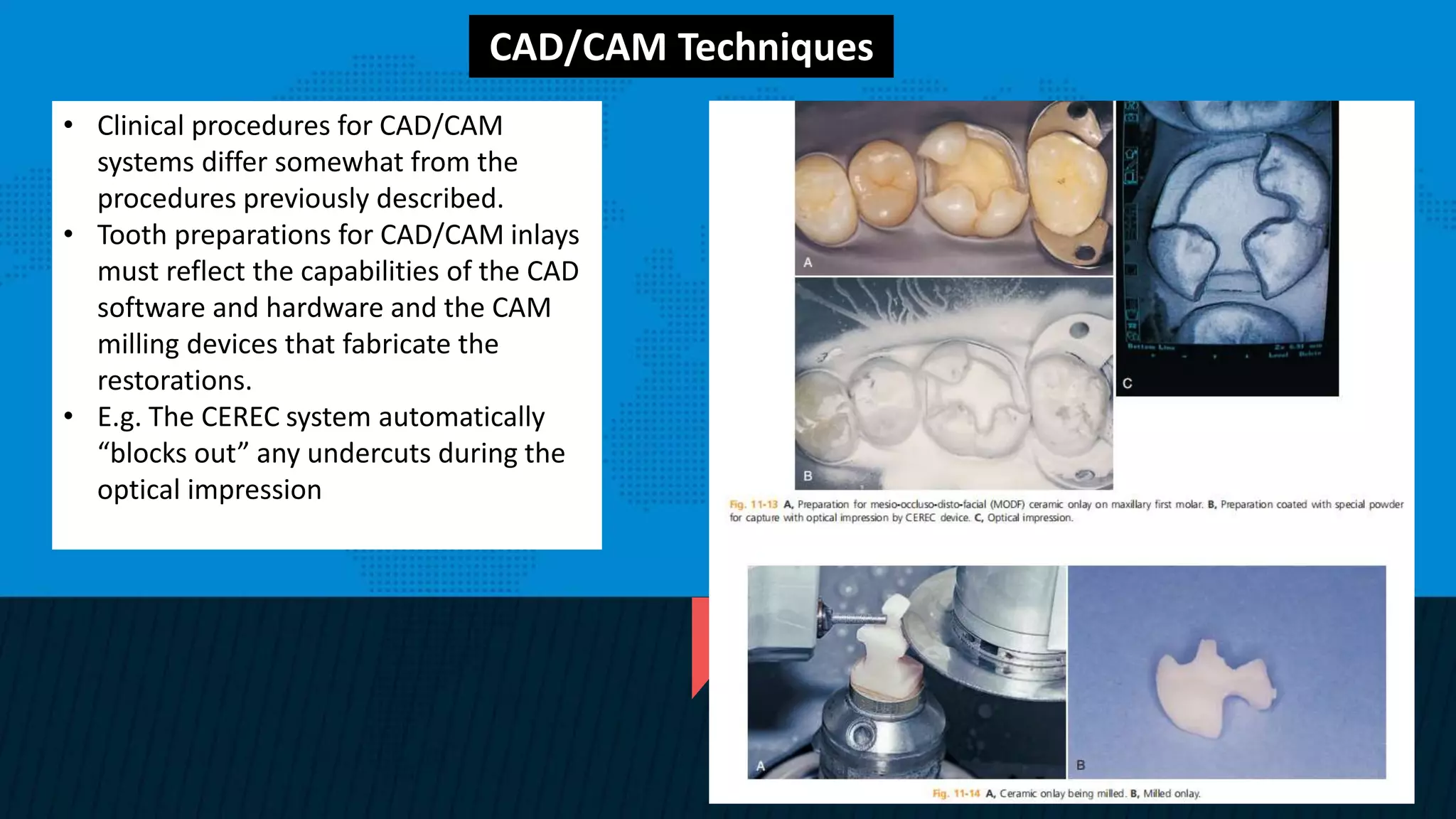 Retention and resistance forms of cavity design | PPTX