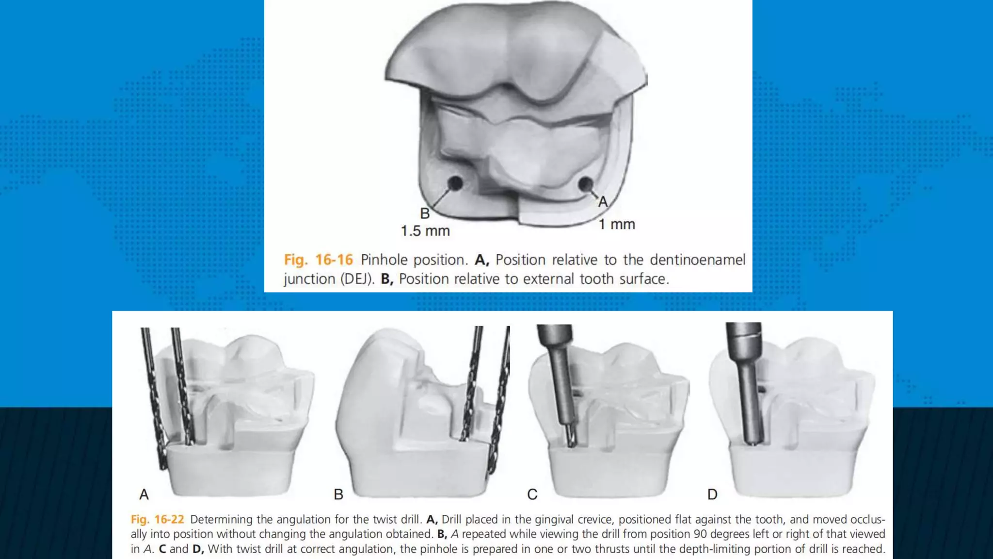 Retention and resistance forms of cavity design | PPTX