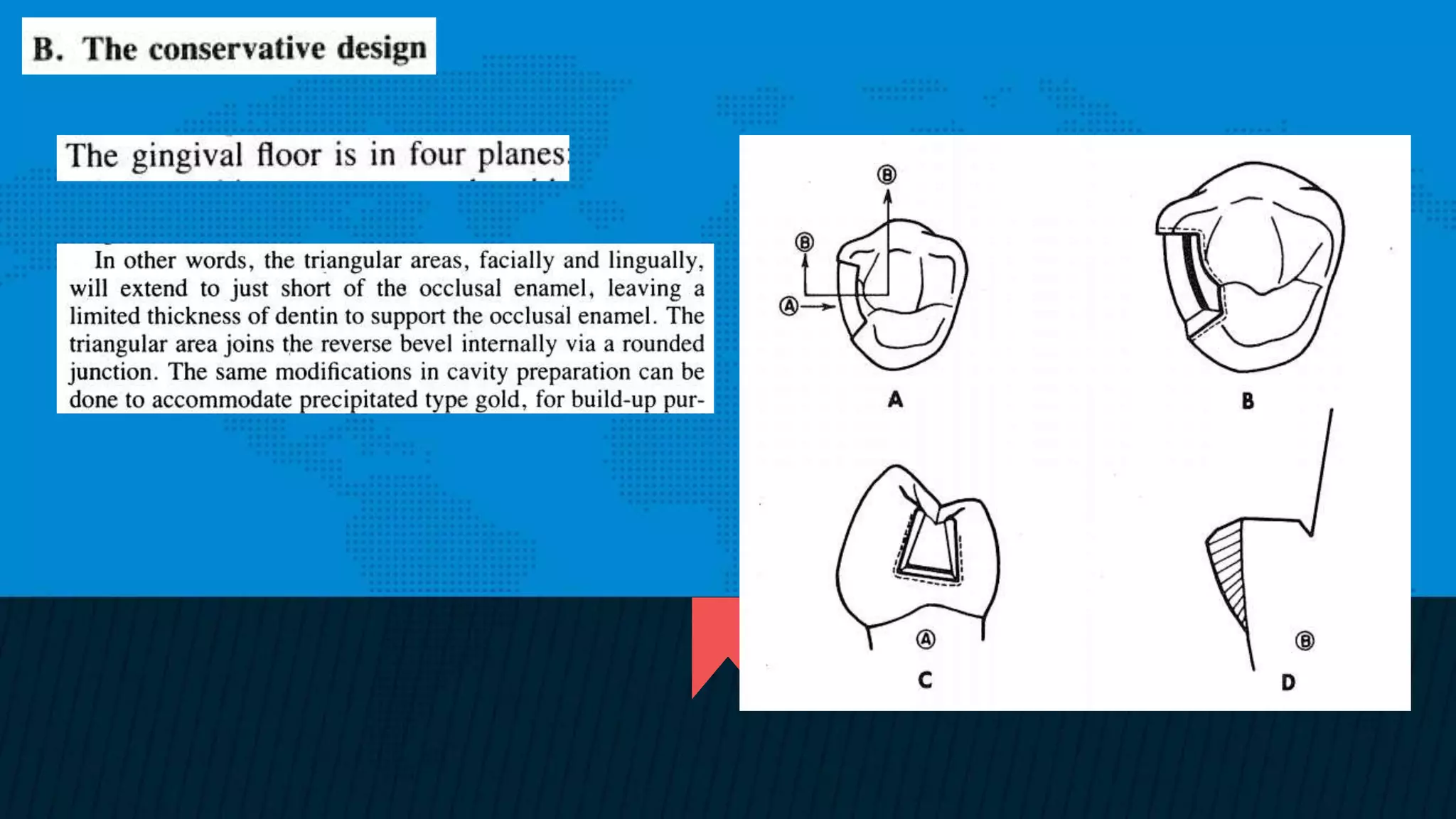 Retention and resistance forms of cavity design | PPTX