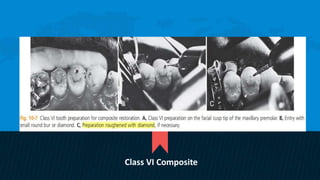 Retention and resistance forms of cavity design | PPTX