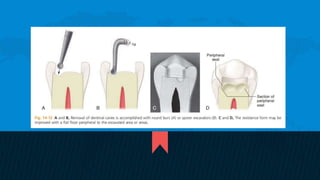 Retention and resistance forms of cavity design | PPTX