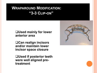 WRAPAROUND MODIFICATION:
“3-3 CLIP-ON”
Used mainly for lower
anterior area
Can realign incisors
and/or maintain lower
incisor space closure
Used if posterior teeth
were well aligned pre-
treatment
 