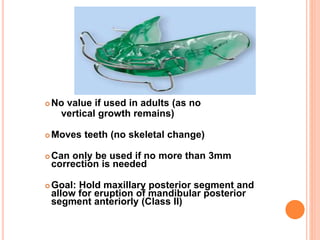  No value if used in adults (as no
vertical growth remains)
 Moves teeth (no skeletal change)
 Can only be used if no more than 3mm
correction is needed
 Goal: Hold maxillary posterior segment and
allow for eruption of mandibular posterior
segment anteriorly (Class II)
 