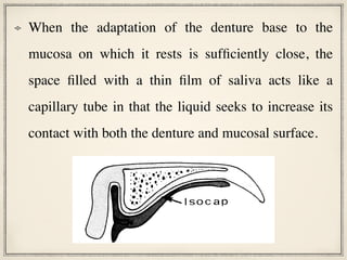 When the adaptation of the denture base to the
mucosa on which it rests is sufficiently close, the
space filled with a thin film of saliva acts like a
capillary tube in that the liquid seeks to increase its
contact with both the denture and mucosal surface.
straighter mandibular incisors. A partially
.................. :::Nx)AMEL.)
xx
..............................
..................... ::cccc)xx
..................... ::)XX))))))XXX
..................... ::XXXXXXXXX
............................ XXXX)XX
- X@ @s .o*sA A A A A . . .................
@-------------------------------------
* vvXXXXXXXX- -A
-***--
*- v*v vvv-- --v-
-A-A
A -A
-A
-A-A
. -A -v -A
e
v**
-................................---
*-..--- FILL----I --- ---.....-
-- --.. .--
--- *..-. . .
..-. ------
* ............
......--
::::::::::::::::::::::::::::::: =--------)
A--..*----....-*..------------.-----
------------------------------------
::::::::::::::: ..::-=- ---
FIG 10.-Capillary penetration around filling.
ner the layer of liquid, the tighter the
peripheral seal (this creates the isolated
capillary) and the greater the wettability,
the greater the adhesion. This component of
denture retention, therefore, is a result of a
strengthening of saliva caused by an in-
creased intermolecular attraction at the
liquid-vapor interface.
Conclusions
Capillary penetration of liquids into nar-
row crevices depends on the wetting of the
solid by the liquid, surface tension of the
liquid, and inversely, on the size of the
opening. The properties of capillary liquid
change when the liquid is trapped in isolated
contact with a solid. The surface tension in-
creases to a value y*. As a result, the
strength of the liquid becomes much greater
and the vapor pressure decreases. The
strength of liquid bridges between solids
may be derived on the basis of this surface
tension increase, rather than on the basis
of a negative pressure within the liquid film.
Human saliva was found to have the tensile
%
I so c a p
FIG 11.-Isocap space between denture and mucosa.
-
 