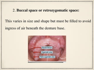 This varies in size and shape but must be filled to avoid
ingress of air beneath the denture base.
2. Buccal space or retrozygomatic space:
 