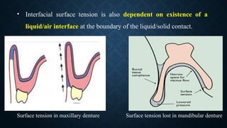 Surface tension in maxillary denture Surface tension lost in mandibular denture
• Interfacial surface tension is also dependent on existence of a
liquid/air interface at the boundary of the liquid/solid contact.
 