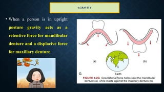 6.GRAVITY
• When a person is in upright
posture gravity acts as a
retentive force for mandibular
denture and a displacive force
for maxillary denture.
 