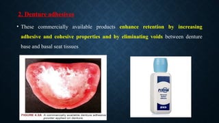 2. Denture adhesives
• These commercially available products enhance retention by increasing
adhesive and cohesive properties and by eliminating voids between denture
base and basal seat tissues
 