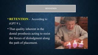 DEFINITION
• RETENTION - According to
(GPT 9 ),
• That quality inherent in the
dental prosthesis acting to resist
the forces of dislodgment along
the path of placement.
 
