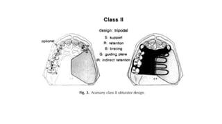 Retention in maxillofacial prosthesis pptx | PPTX