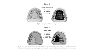 Retention in maxillofacial prosthesis pptx | PPTX