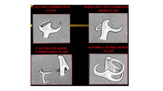Retention in maxillofacial prosthesis pptx | PPTX
