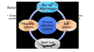 Retention in maxillofacial prosthesis pptx | PPTX