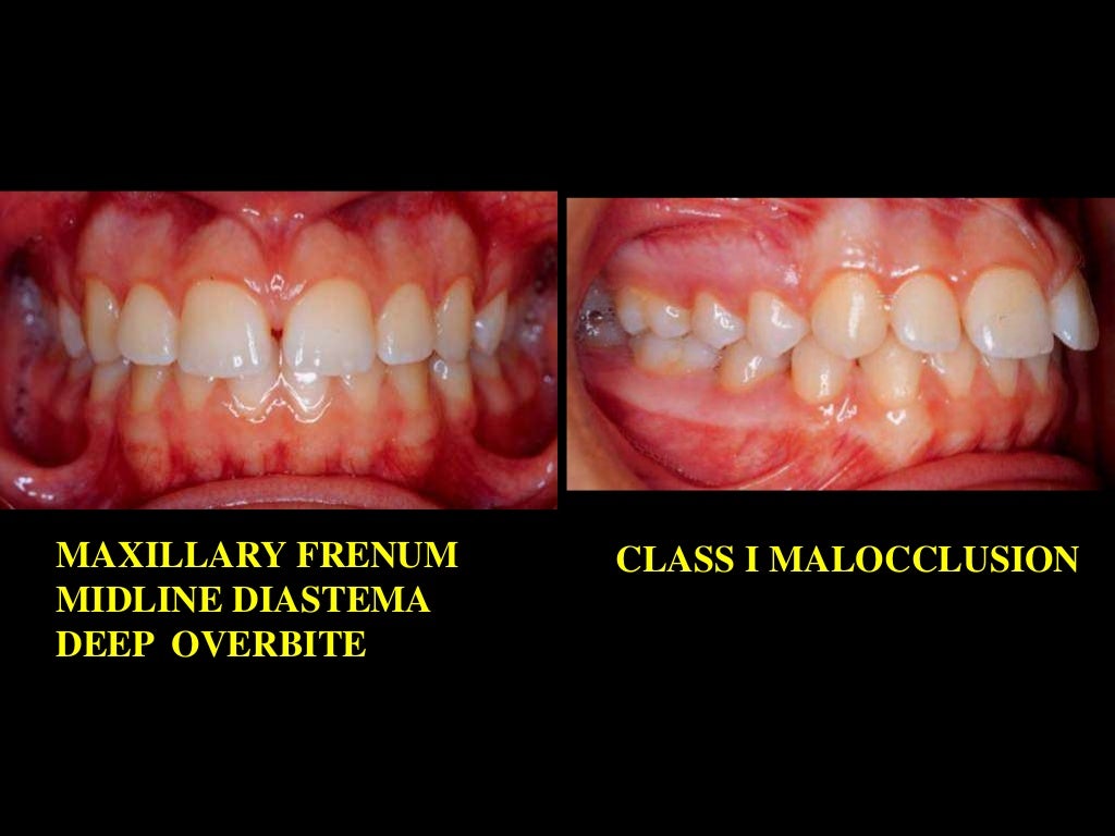 Retention /certified fixed orthodontic courses by Indian dental acad…