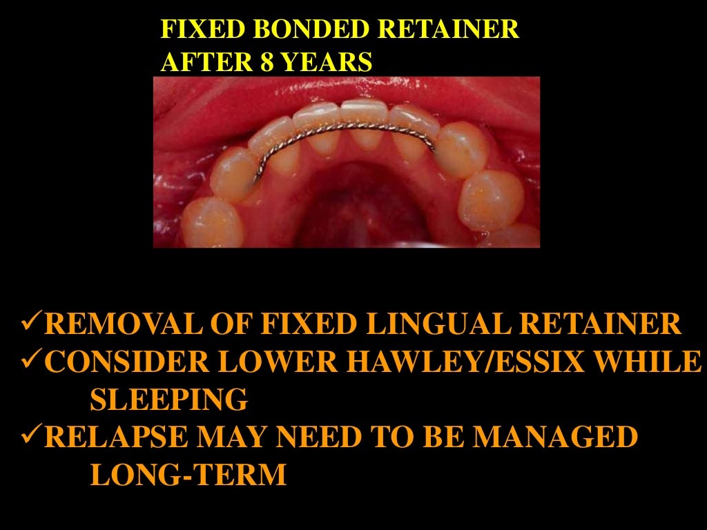 Retention /certified fixed orthodontic courses by Indian dental acad…