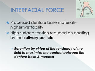  Processed denture base materials-
higher wettability
 High surface tension reduced on coating
by the salivary pellicle
› Retention by virtue of the tendency of the
fluid to maximize the contact between the
denture base & mucosa
 