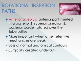  Anterior alveolus: anterior part inserted
in a posterior & superior direction &
posterior border rotated over the
tuberosities
 More important when other retentive
mechanisms are weak:
 Loss of normal anatomical contours
 Surgically created undercuts
 