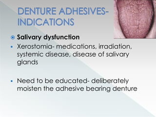  Salivary dysfunction
 Xerostomia- medications, irradiation,
systemic disease, disease of salivary
glands
 Need to be educated- deliberately
moisten the adhesive bearing denture
 