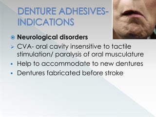  Neurological disorders
 CVA- oral cavity insensitive to tactile
stimulation/ paralysis of oral musculature
 Help to accommodate to new dentures
 Dentures fabricated before stroke
 
