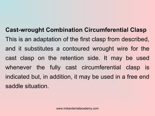Cast-wrought Combination Circumferential Clasp
This is an adaptation of the first clasp from described,
and it substitutes...