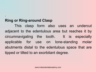 .
Ring or Ring-around Clasp
This clasp form also uses an undercut
adjacent to the edentulous area but reaches it by
circum...