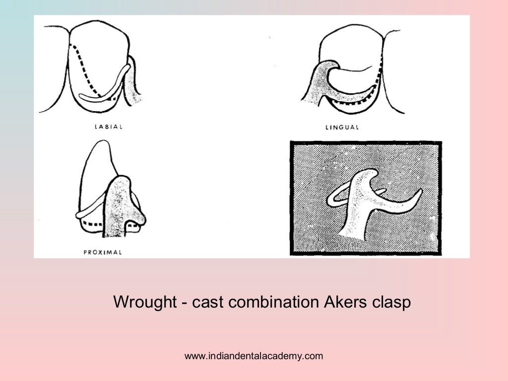 Retention of maxillofacial prosthesis/ oral surgery courses