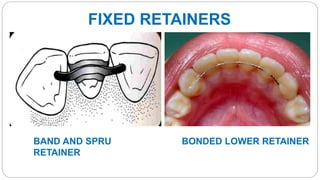 Retention & relapce in orthodontics | PPTX