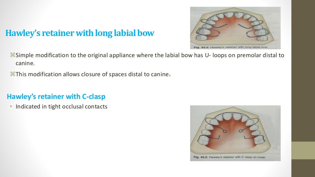 Retention & relapse in orthodontics