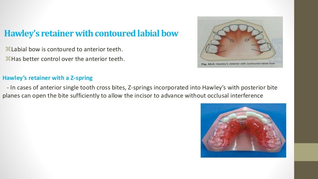Retention & relapse in orthodontics