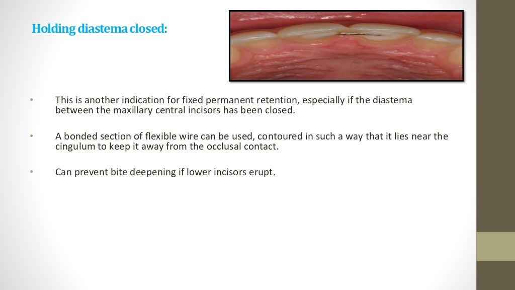 Retention & relapse in orthodontics