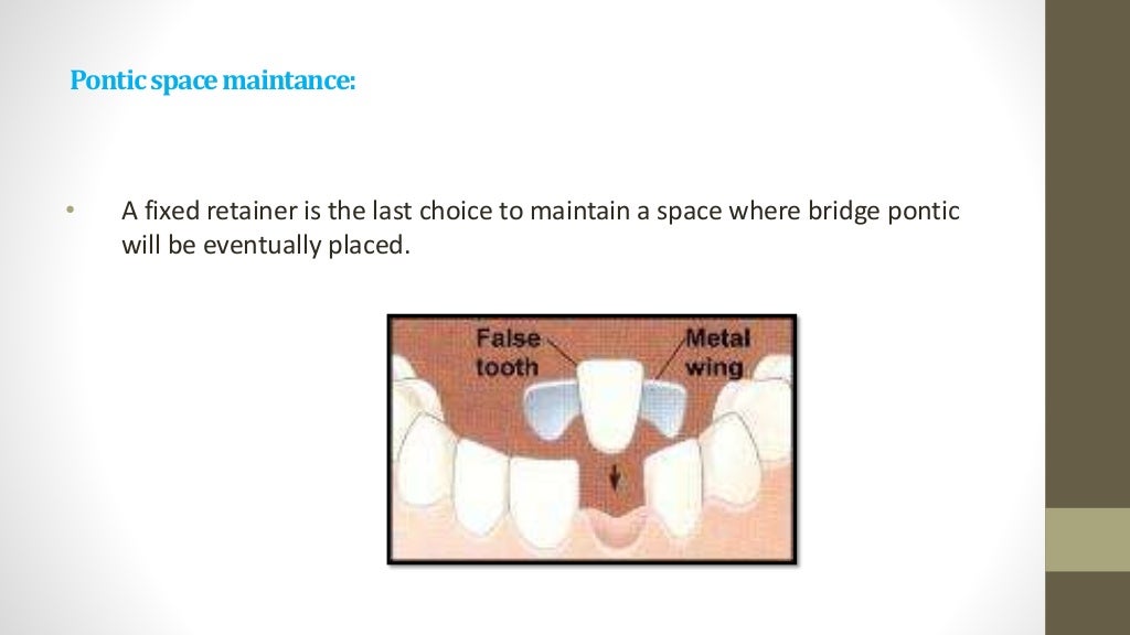 Retention & relapse in orthodontics