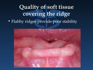 Quality of soft tissue
covering the ridge
• Flabby ridges provide poor stability
 
